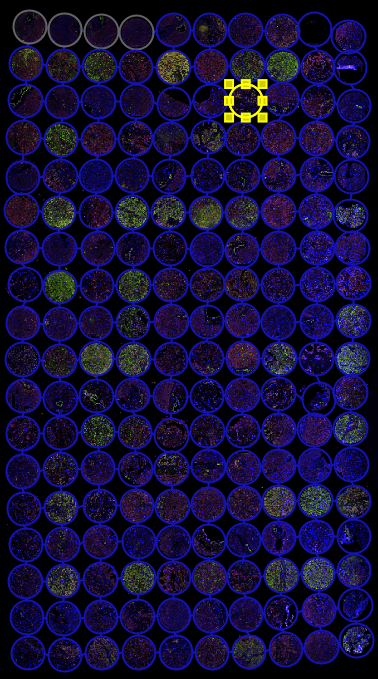 图像自动识别与切割-A